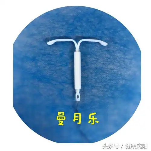 健康科普堂|世界避孕日,专家跟您聊聊上环那些事儿