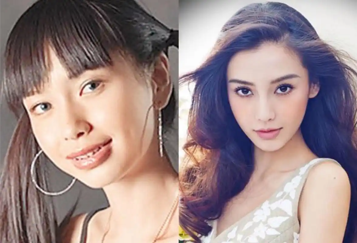 终于相信杨颖的"整牙变美"说法,看看整牙后的傅园慧,就是例子