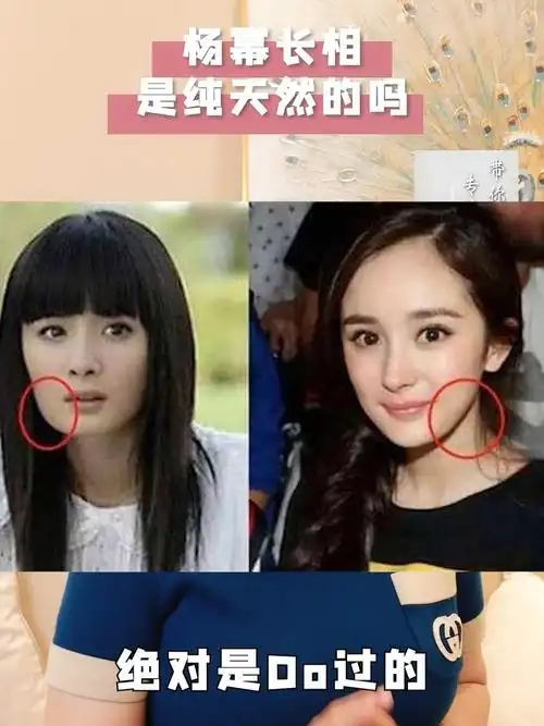 杨幂的下颌角do的痕迹很明显,衰老也加速_杨幂_下颌角_医美_do脸_娱乐