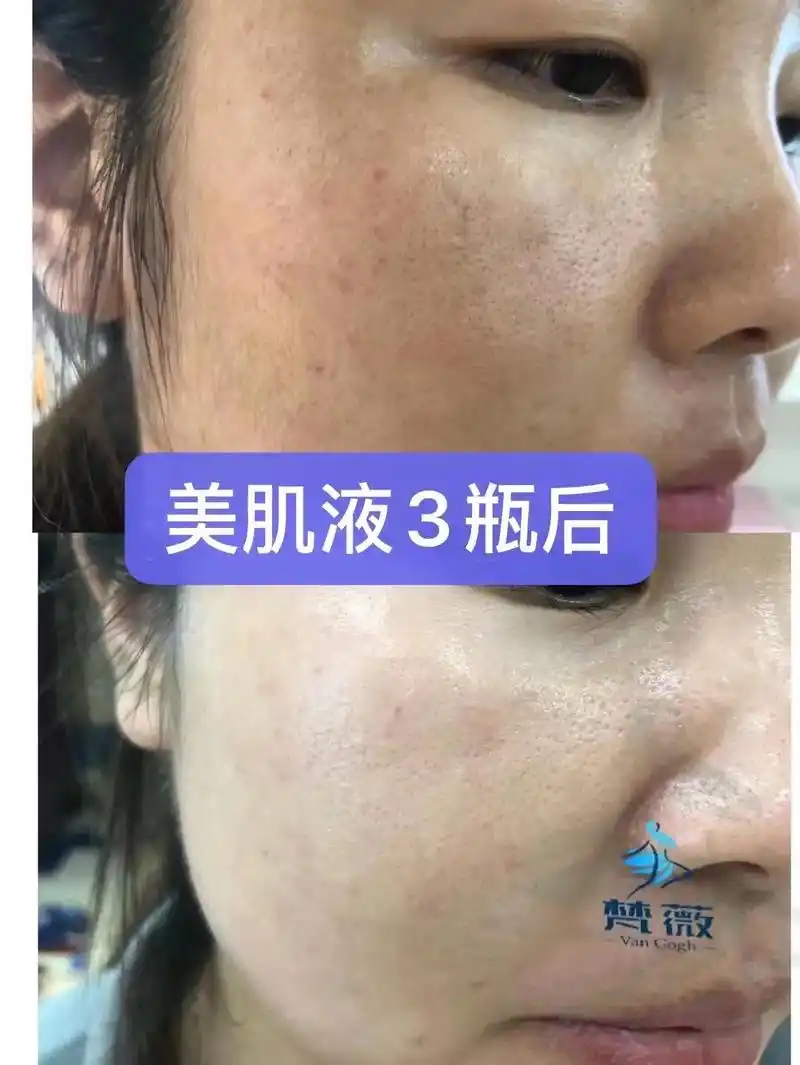 美肌水净化细胞再生功能