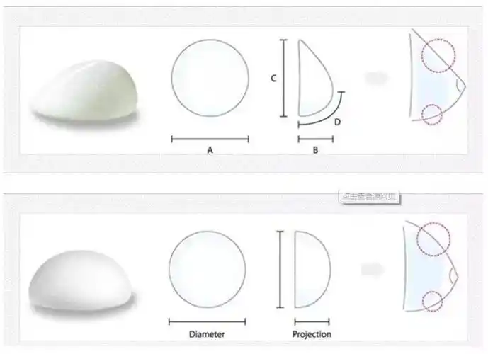 [:32]水滴美胸谁能拒绝!水滴形胸部是从侧面看_圈子-新氧美容整形