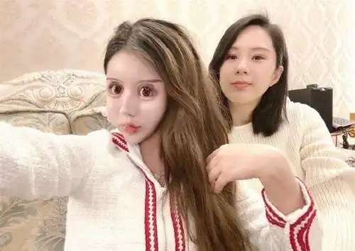 女孩13岁开始整容60次,脸似芭比娃娃:极端的审美,源于童年时期