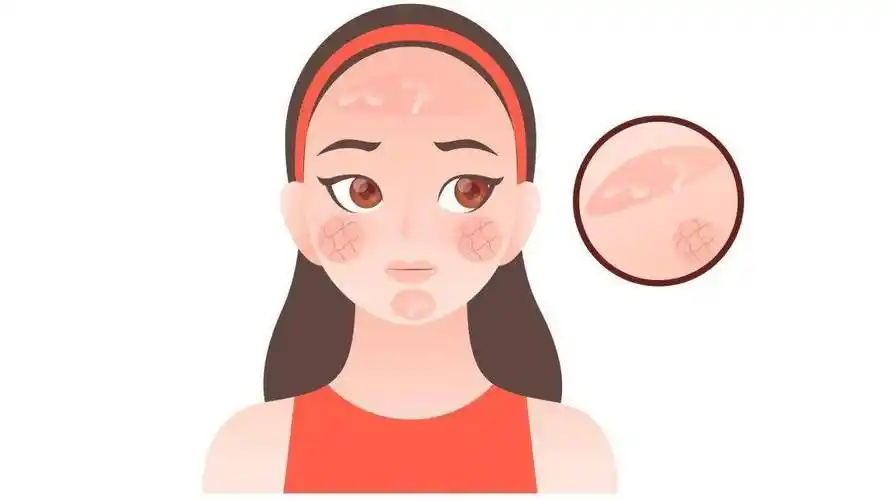 快夏天了,为什么我的皮肤"又油又干"?