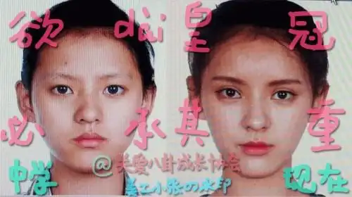 王思聪前女友张予曦整容前旧照:丰额头割双眼皮