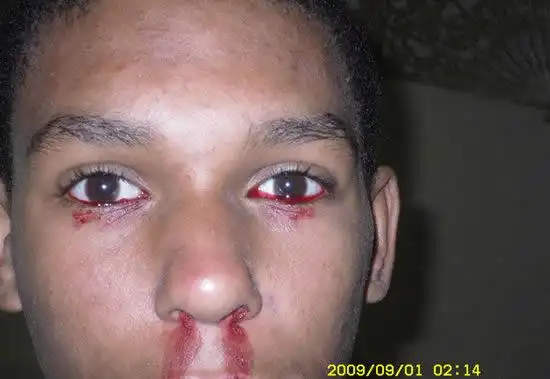 外国男子眼流血泪