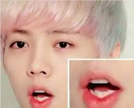 鹿晗网友们都喊你去整牙