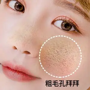 疏通毛孔堵塞护肤品