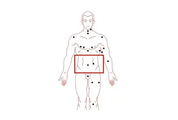 67男人肚子上长痣命好吗