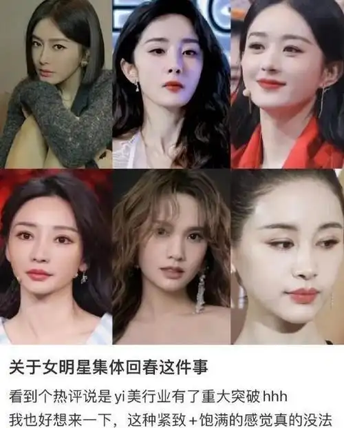 娱乐圈的女明星们真的是大规模回春了真的有新技术吗