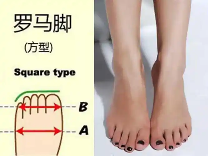 小仙女们看好了脚型再买鞋