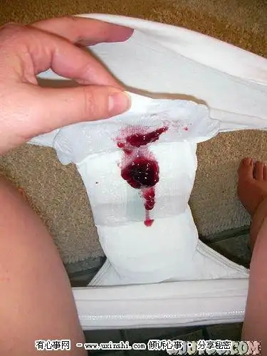 年轻美女来大姨妈卫生巾上带血,女人来月经流血图片及注意事项