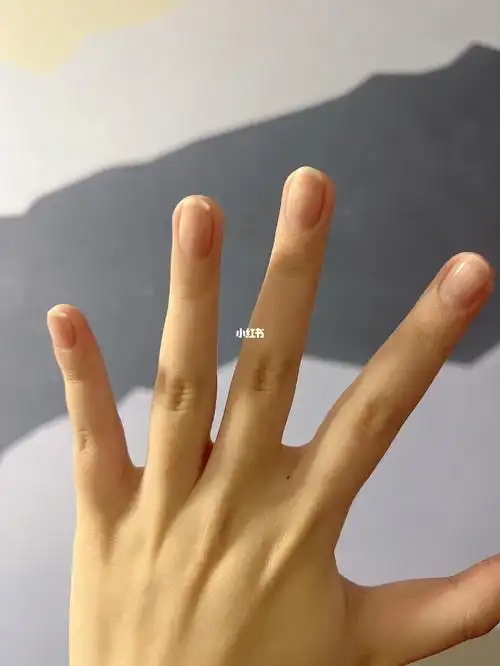 左手食指和中指之间突然长了颗痣有什么说法