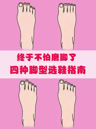 四种脚型选鞋指南速看