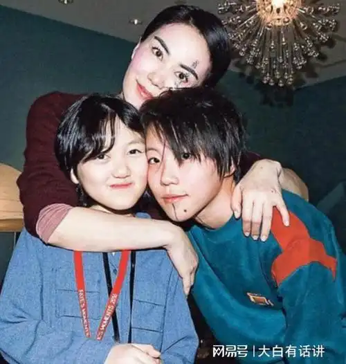 王菲花百万为女儿治疗唇裂如今嘴是治好了脸却越来越奇怪了