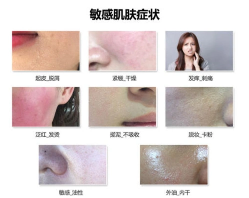 敏感性皮肤常犯的错误,如何规避?