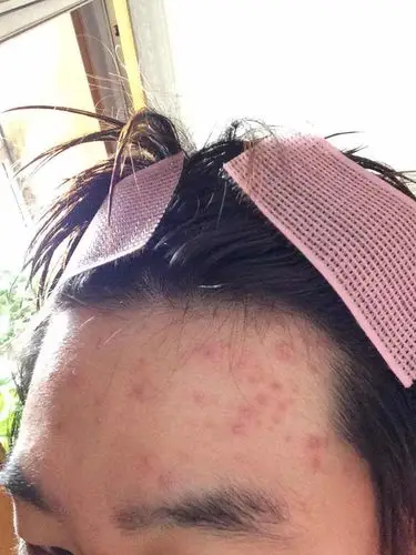 请大师指点,是什么问题,怎样好转.