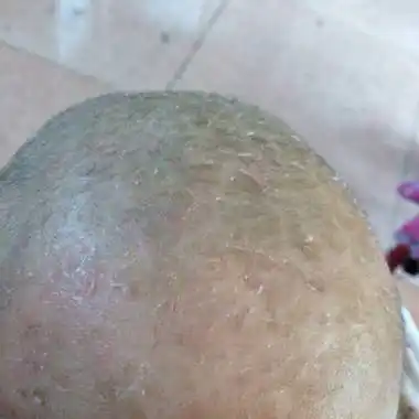 育儿问题这裏搜 取消 最佳回答          宝妈,估计是宝宝脱皮了,没