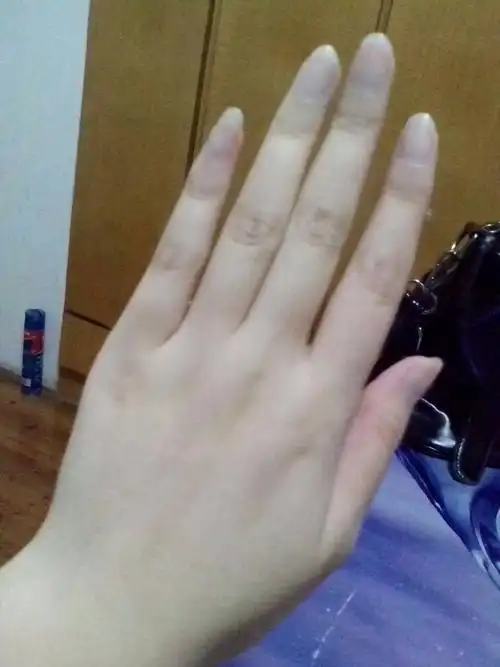 这是几岁女孩的手?