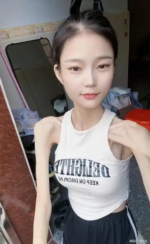 广东一女子身高一米六骨瘦如柴体重不到60斤她却觉得自己很美