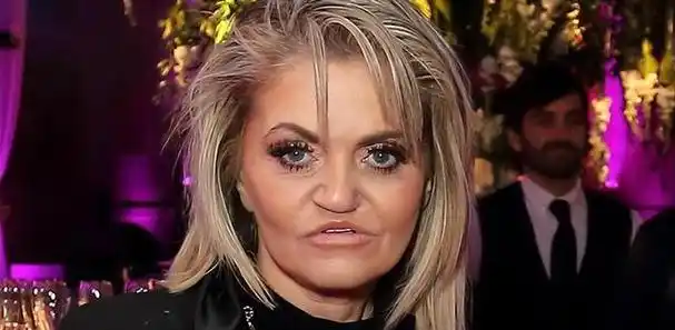 整容变毁容:网红百万整成女鬼,女星头顶整出大洞,简直惨不忍睹