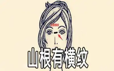 山根有横纹的女人命运怎么样