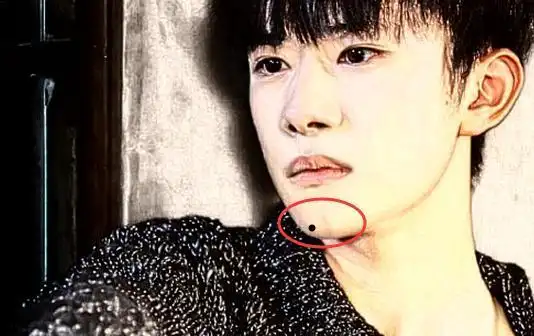 下巴长痣下巴在面相中代表一个人的晚年运势,下巴饱满,有吉痣,都为吉