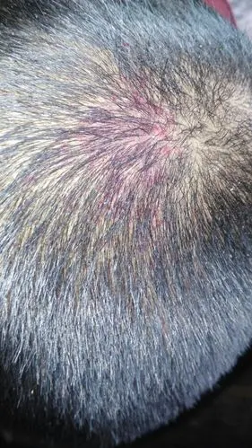 头皮上有红斑,不疼不痒,是怎么回事,请专业人员解答