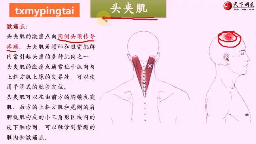 头夹肌,胸锁乳突肌,颈椎单元化扎法——天下明医平台简灵奇针