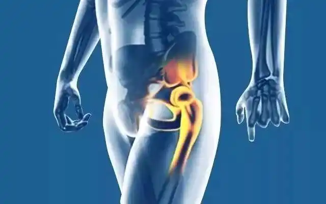 "大腿根"疼的那些事儿