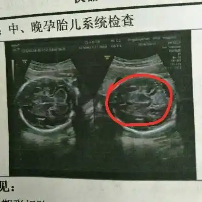 中间那个是小鸡鸡吗?