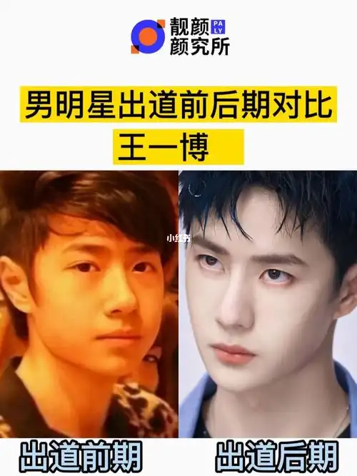 男明星出道前后对比之王一博_王一博_昆明鹏爱靓颜整形医院攻略_中国