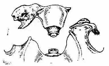 第四节 全子宫切除术