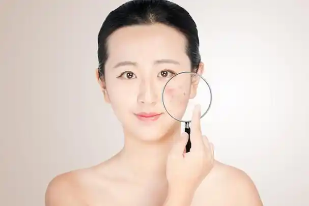 【敏感性皮肤长痘怎么办】敏感性皮肤长痘怎么办 敏感性肌肤如何祛痘