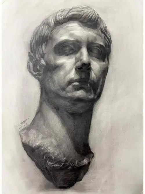 又是一个不知道名字的石膏步骤