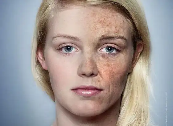 皮肤衰老有哪些?