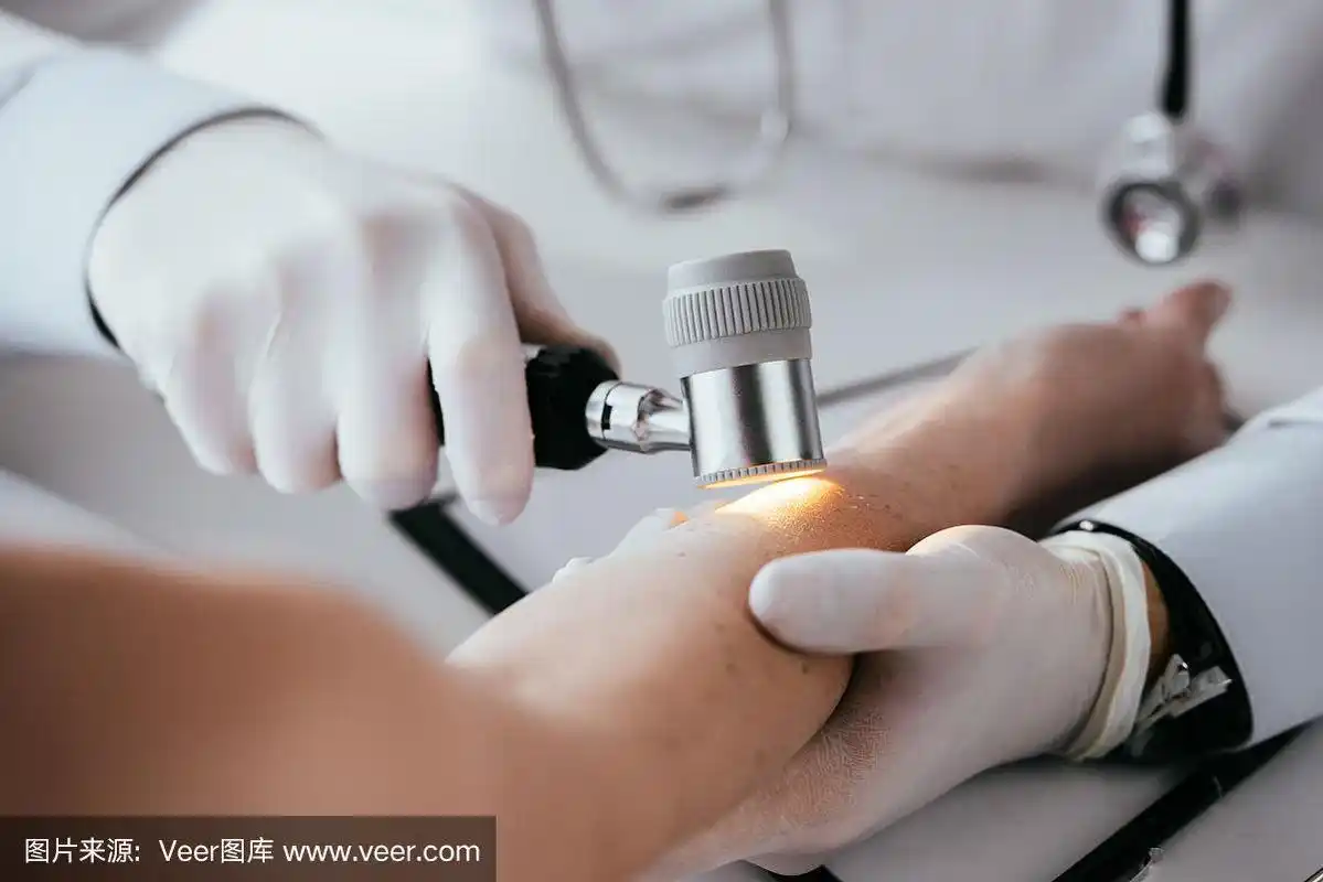 皮肤科医生拿着皮镜检查妇女的手