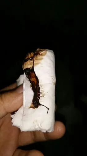 怀孕流红色血做检查确定在宫内打黄体酮针够成了黑色两天后有这个到底