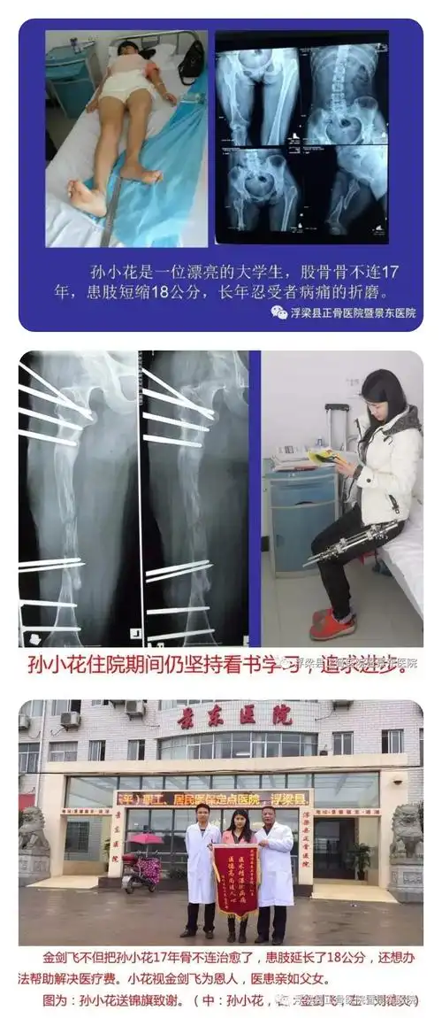 病例三:四肢离断典型病例