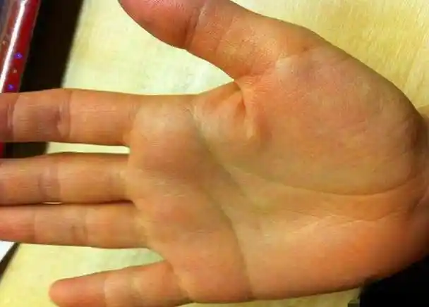 小指能过三关的人,天生就是富贵命,容易发大财!