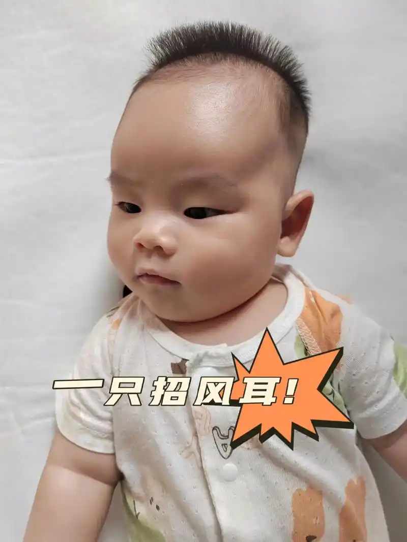 宝宝只有一只耳朵是招风耳,三个月大了 - 抖音