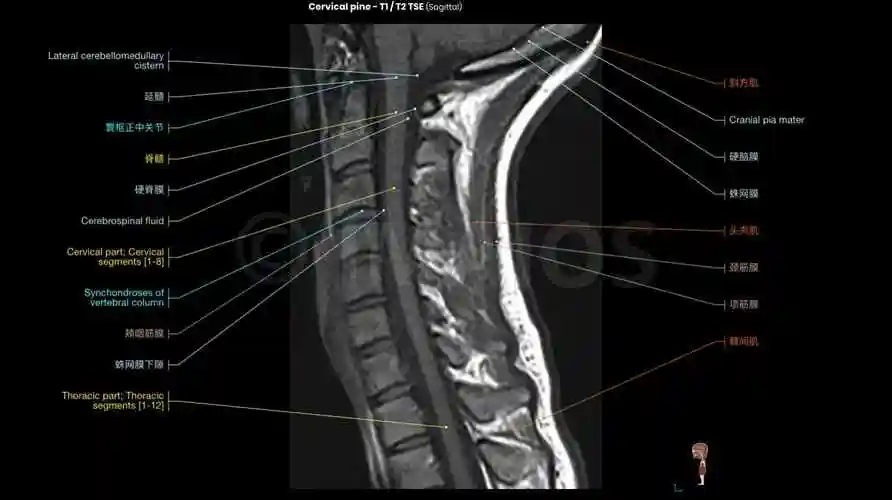 颈椎mri解剖图轴向冠状矢状切片