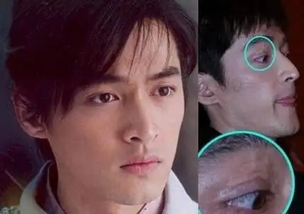 胡歌车祸前后对比图,胡歌对比照(胡歌被车撞前后照片)