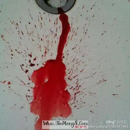女人梦见自己掉了牙齿出好多血 女人梦见自己掉了牙齿