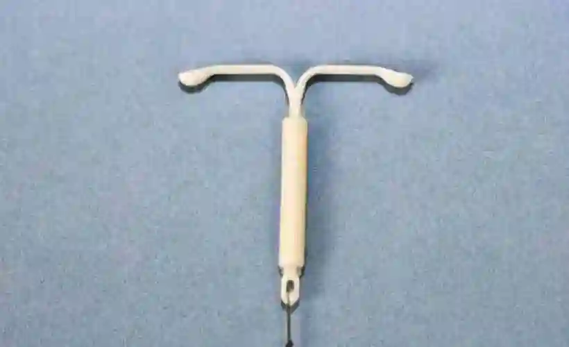 爱母节育环怎么样具有哪些优点