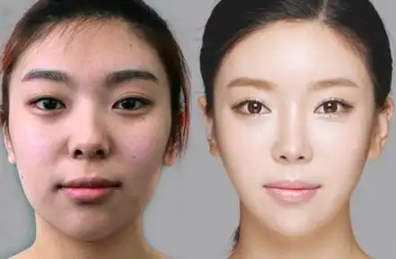 北京澳玛星光美白紧肤案例_整容日记_整形前后对比照_【经典整形网】