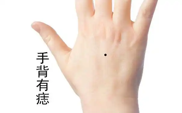 手背痣相图解女手背痣是你走好运的预兆并非网传辜负心爱之人