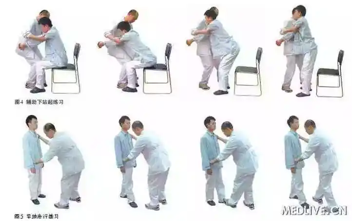 学员解读脑卒中偏瘫患者步行步态如何科学训练