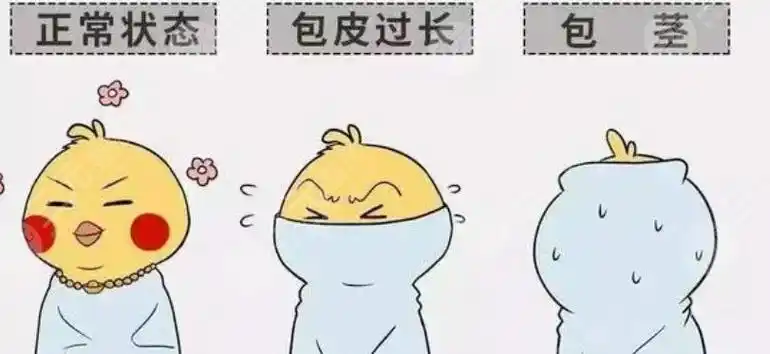 3,割包皮手术后恢复需要多长时间?