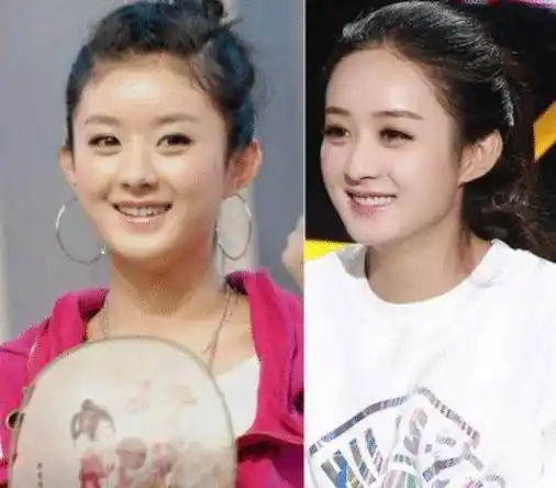 明星刚出道的样子,赵丽颖像路人,杨幂方出天际,他像极了小奶狗_靳东