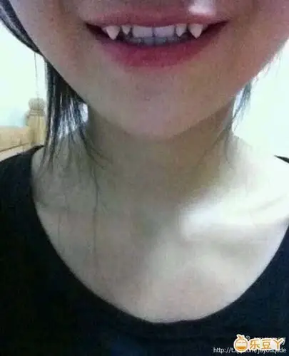 这才是真正的虎牙